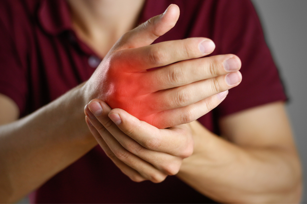 CBD e Artrite: Come può aiutare a ridurre il Dolore e l'Infiammazione - Bongae